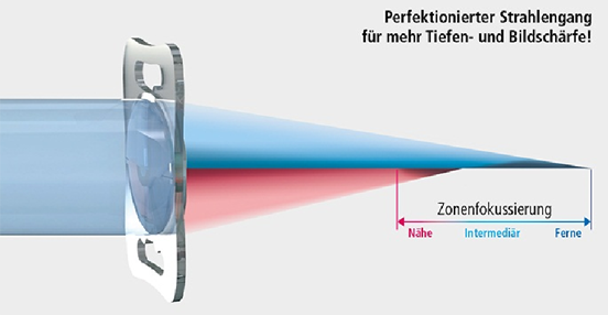 レンティスMplus　Lentis Mplus