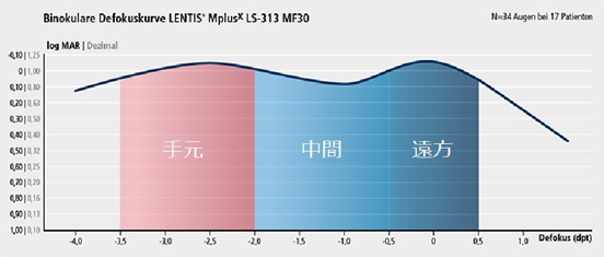 レンティスMplus　Lentis Mplus
